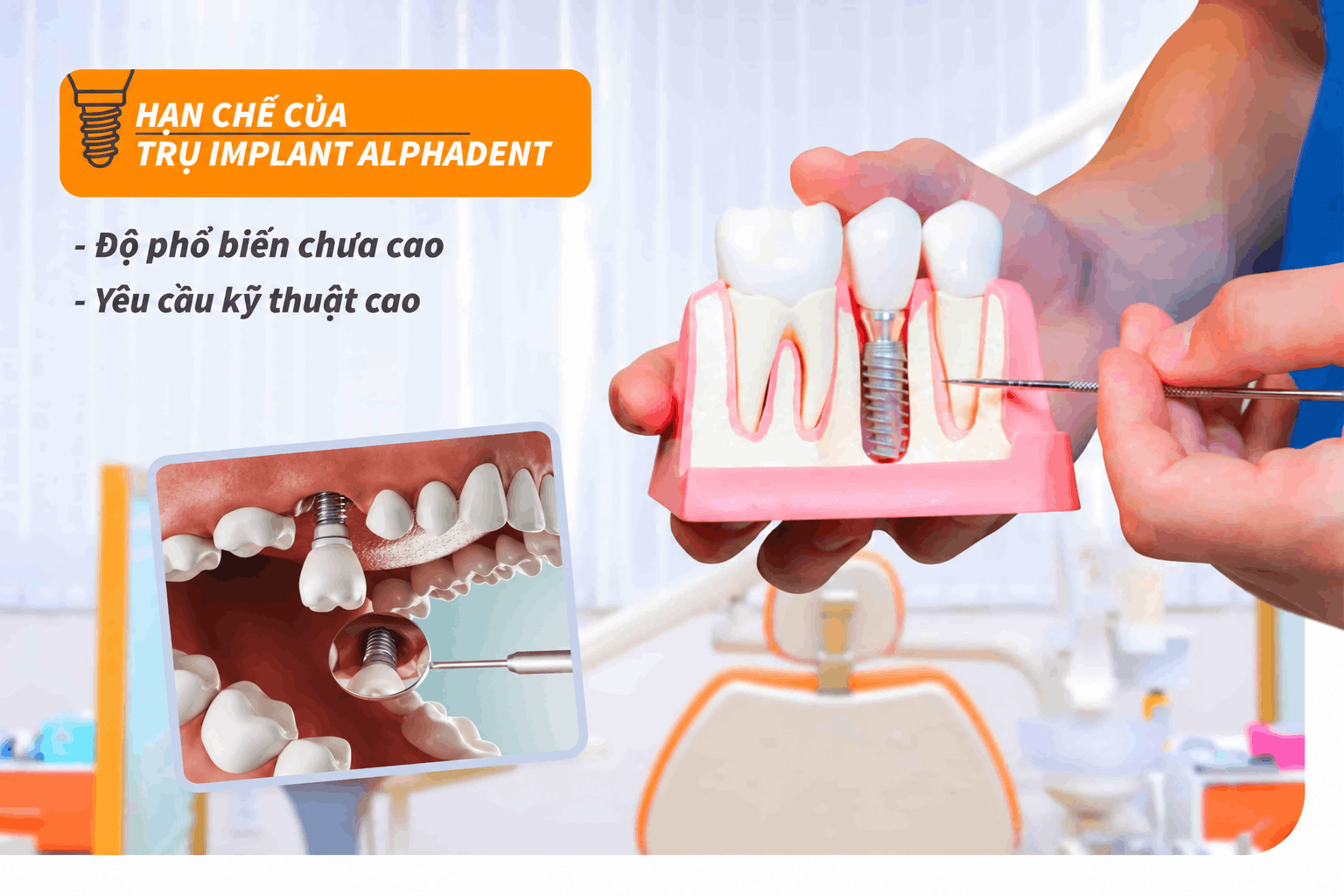 Hạn chế của trụ Implant Alphadent