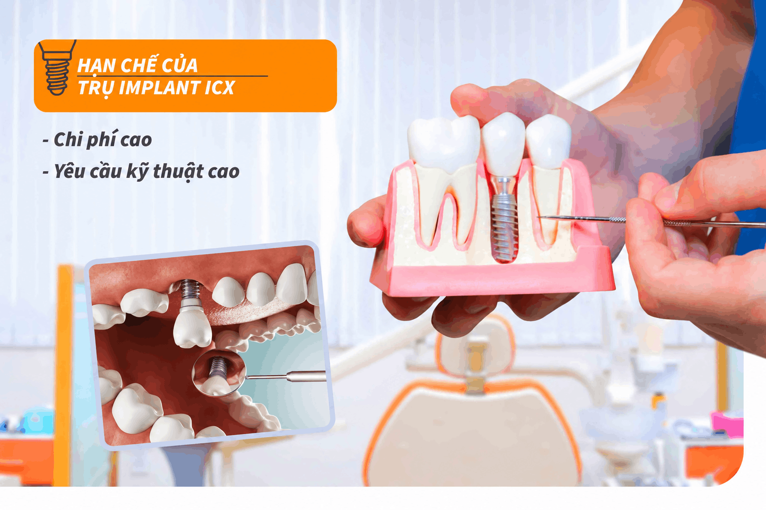 Hạn chế của trụ Implant ICX