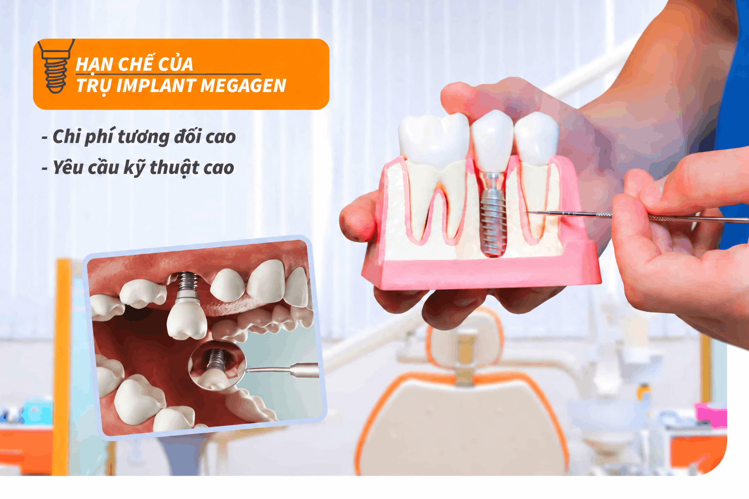 Hạn chế trụ Implant Megagen
