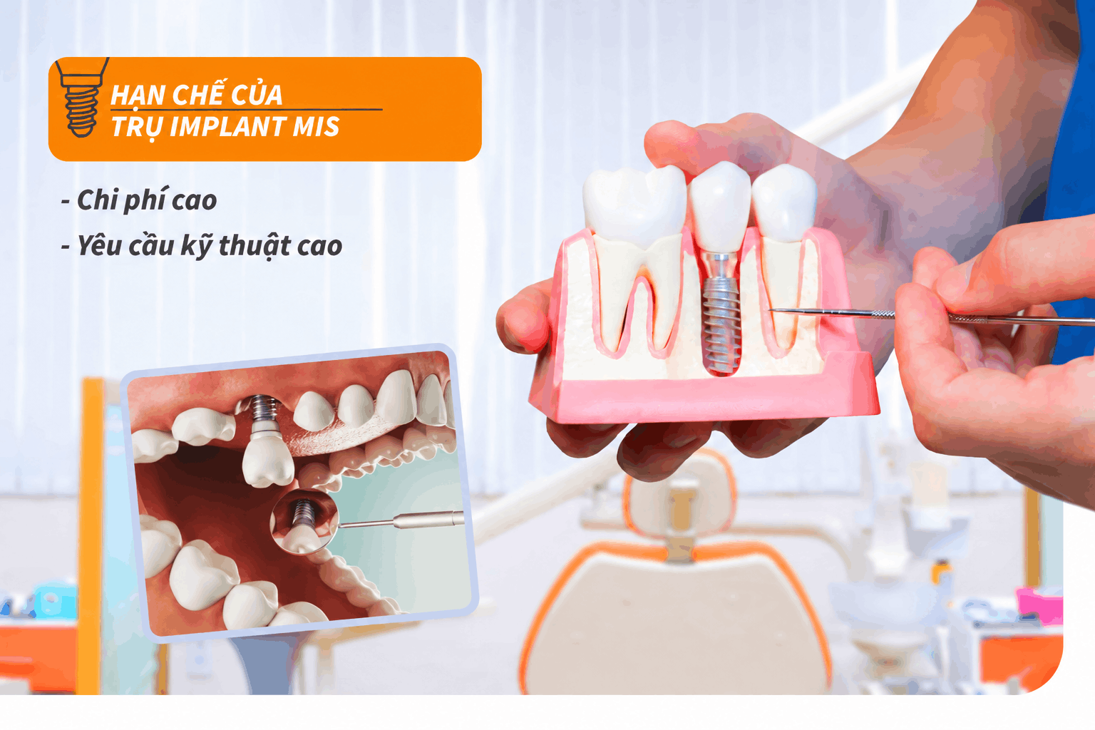 Hạn chế của trụ Implant MIS