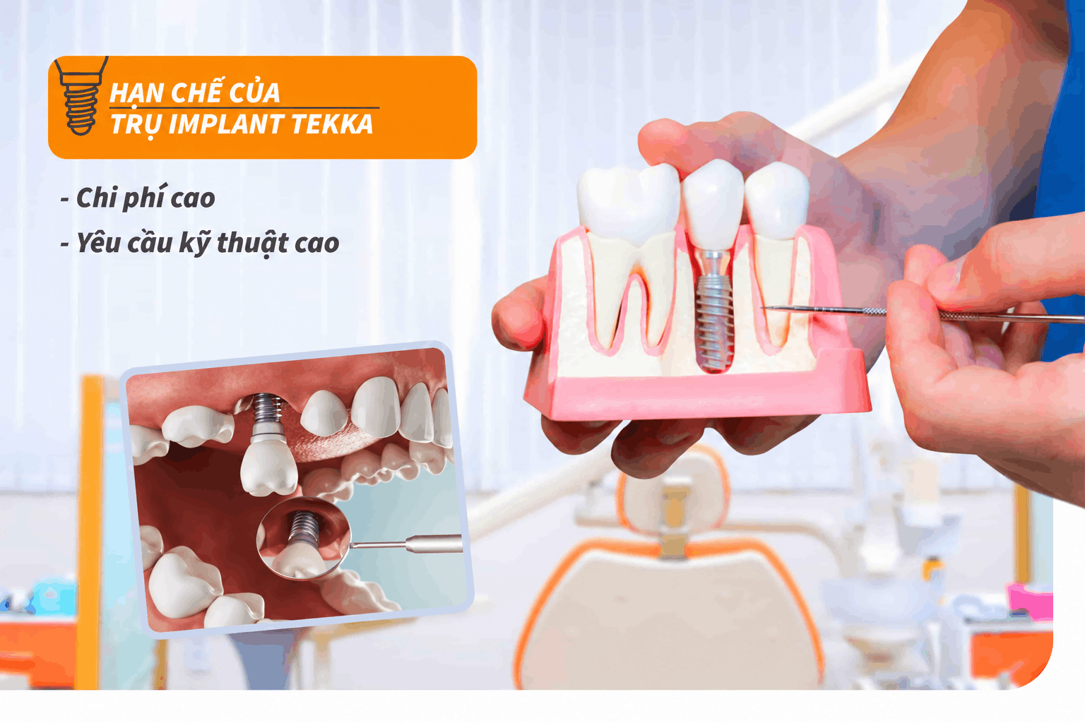 Hạn chế của trụ Implant Tekka
