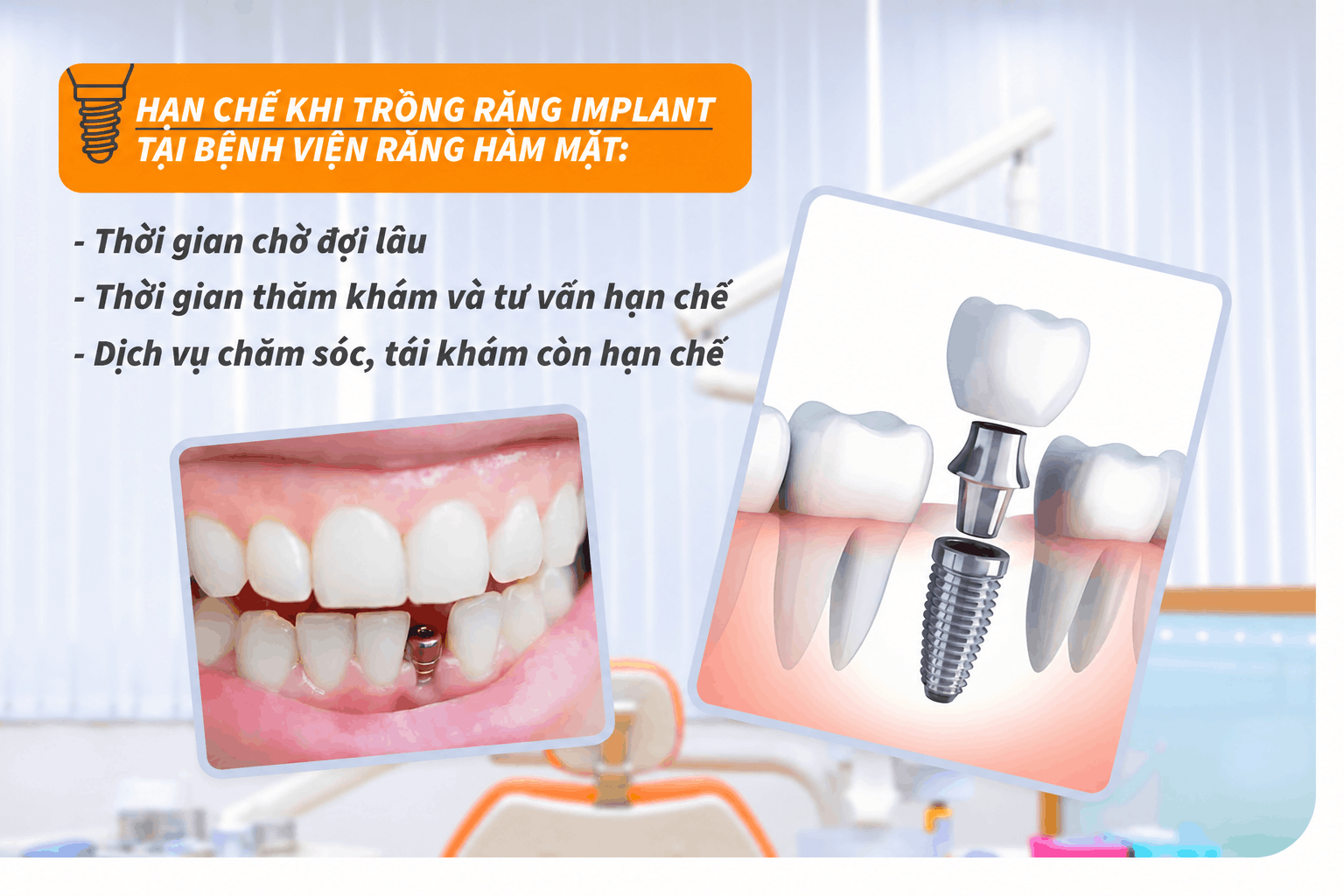 Hạn chế khi trồng răng Implant tại bệnh viện răng hàm mặt