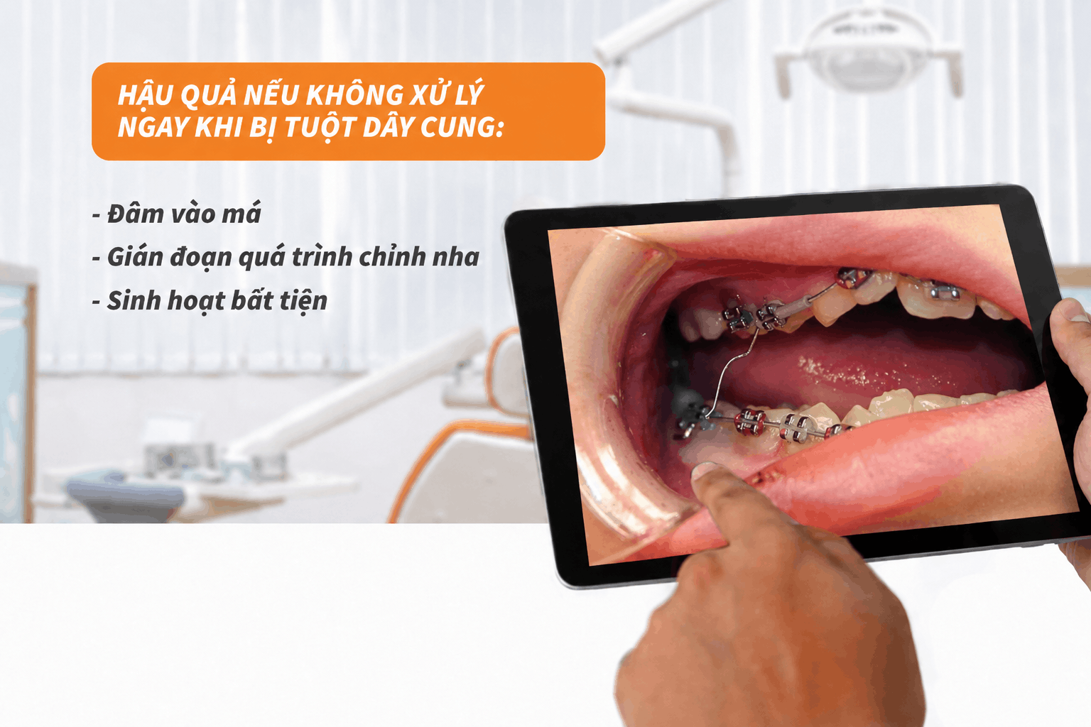 Hậu quả nếu không xử lý ngay khi bị tụt dây cung