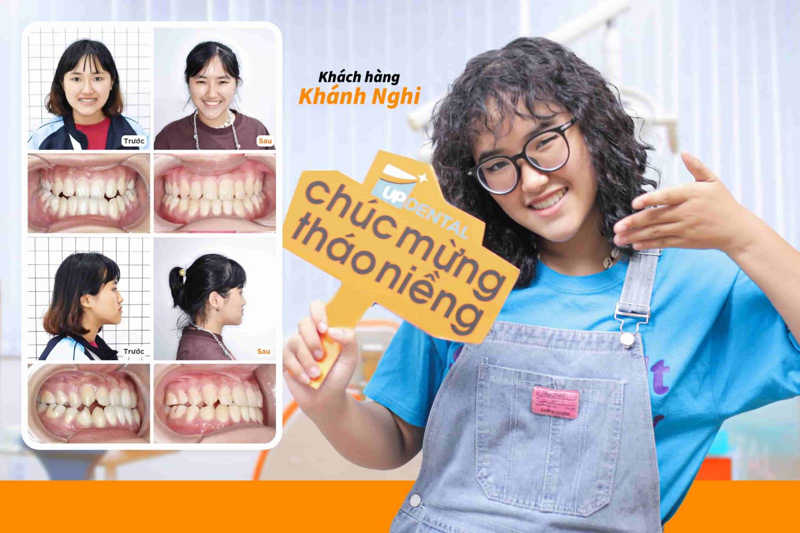 Khách hàng Khánh Nghi