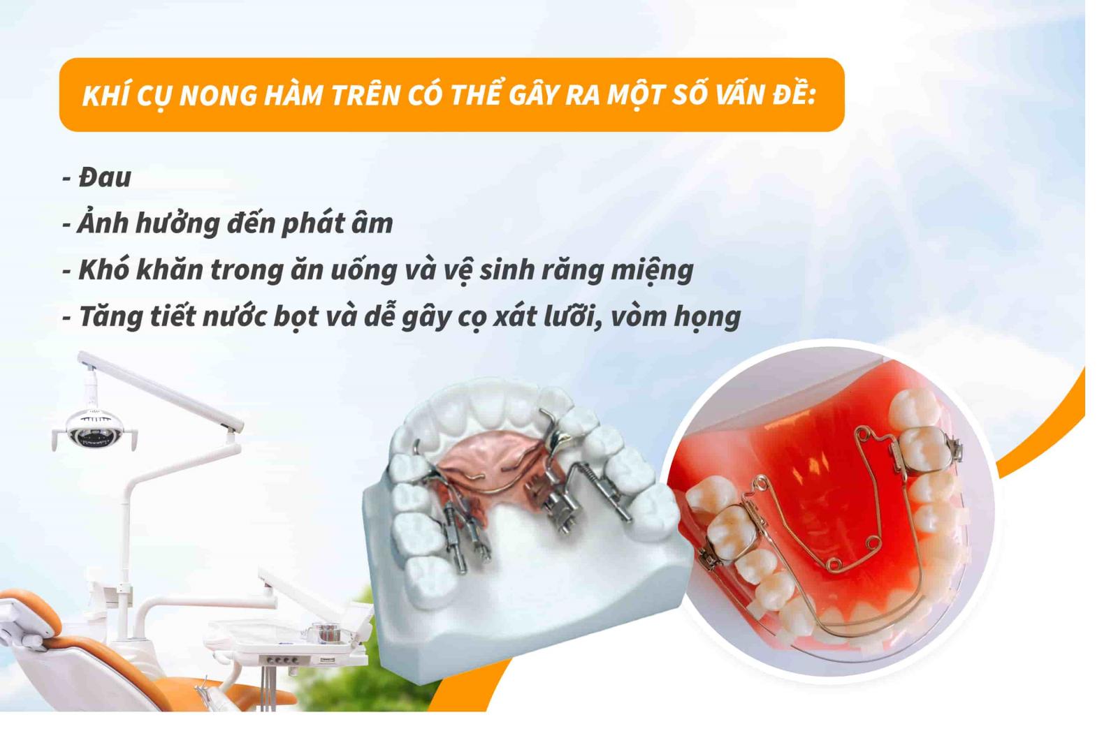 Khí cụ nong hàm trên có gây ảnh hưởng gì không? 