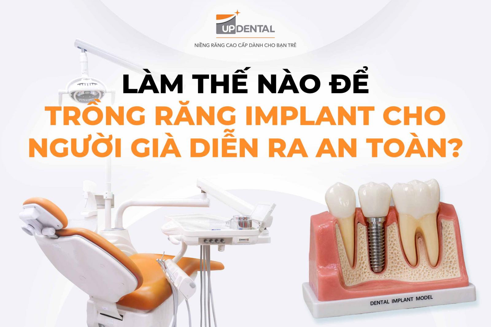 Làm thế nào để trồng răng Implant cho người già diễn ra an toàn?
