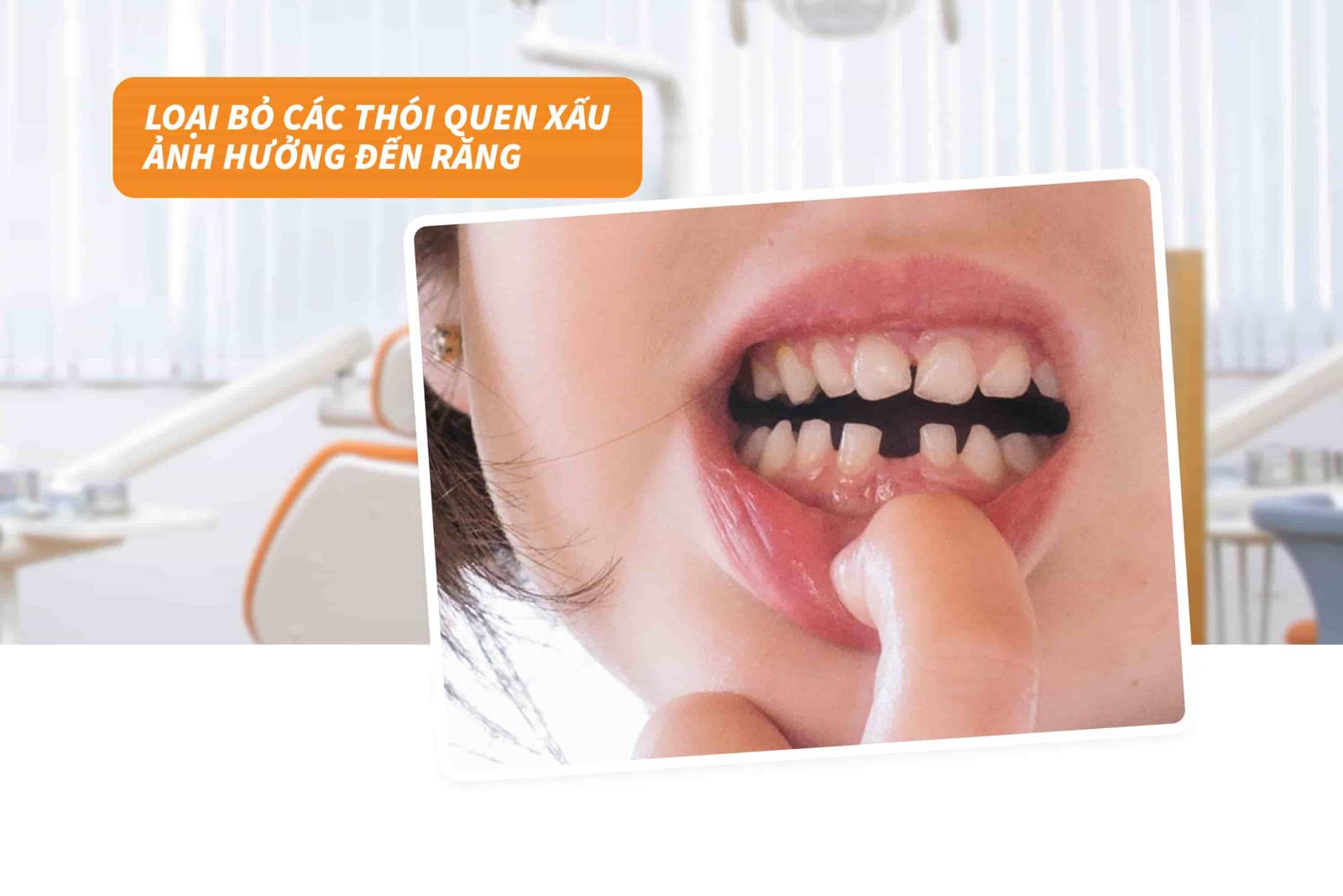 Loại bỏ các thói quen xấu ảnh hưởng đến răng