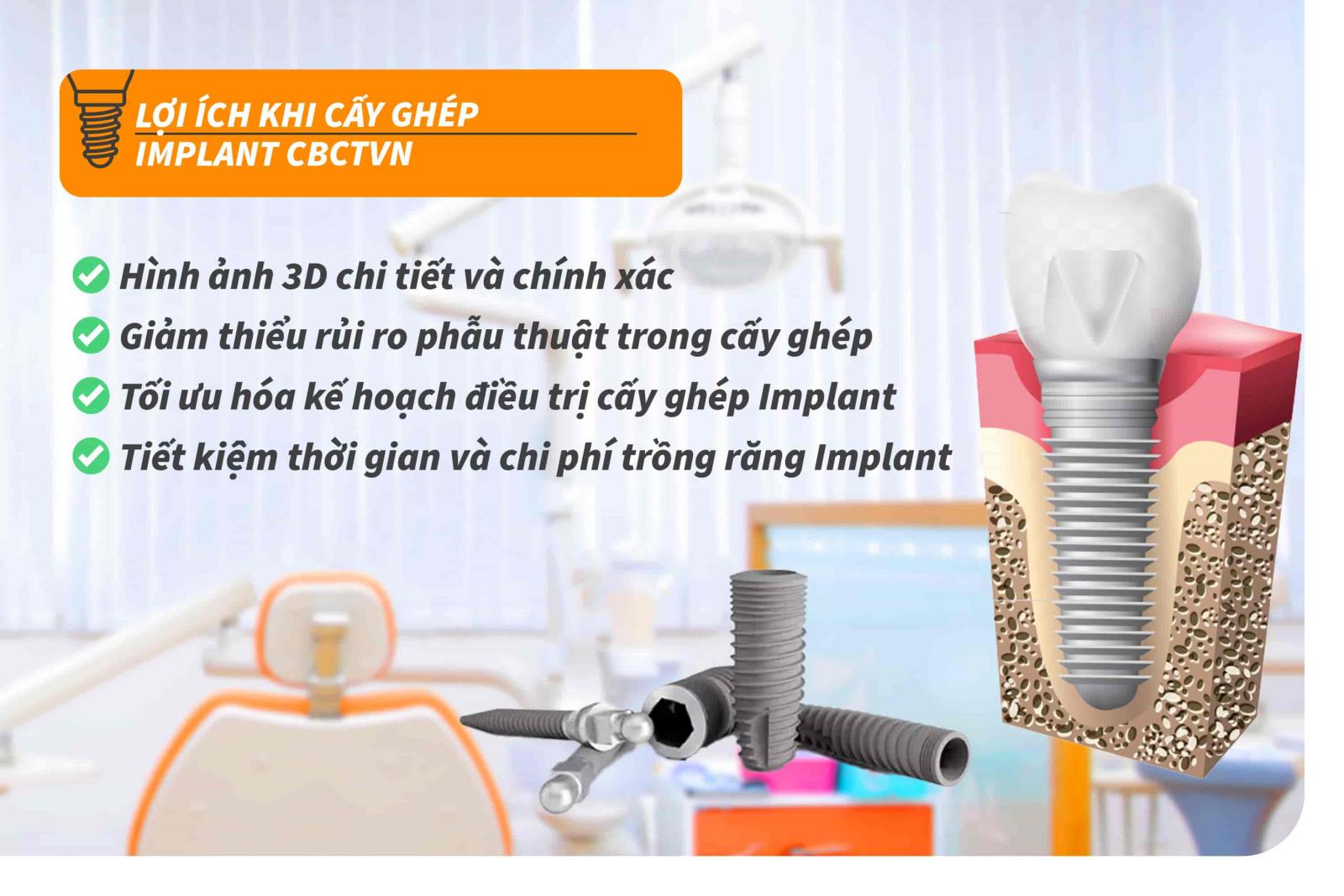 Lợi ích khi cấy ghép Implant CBCTVN