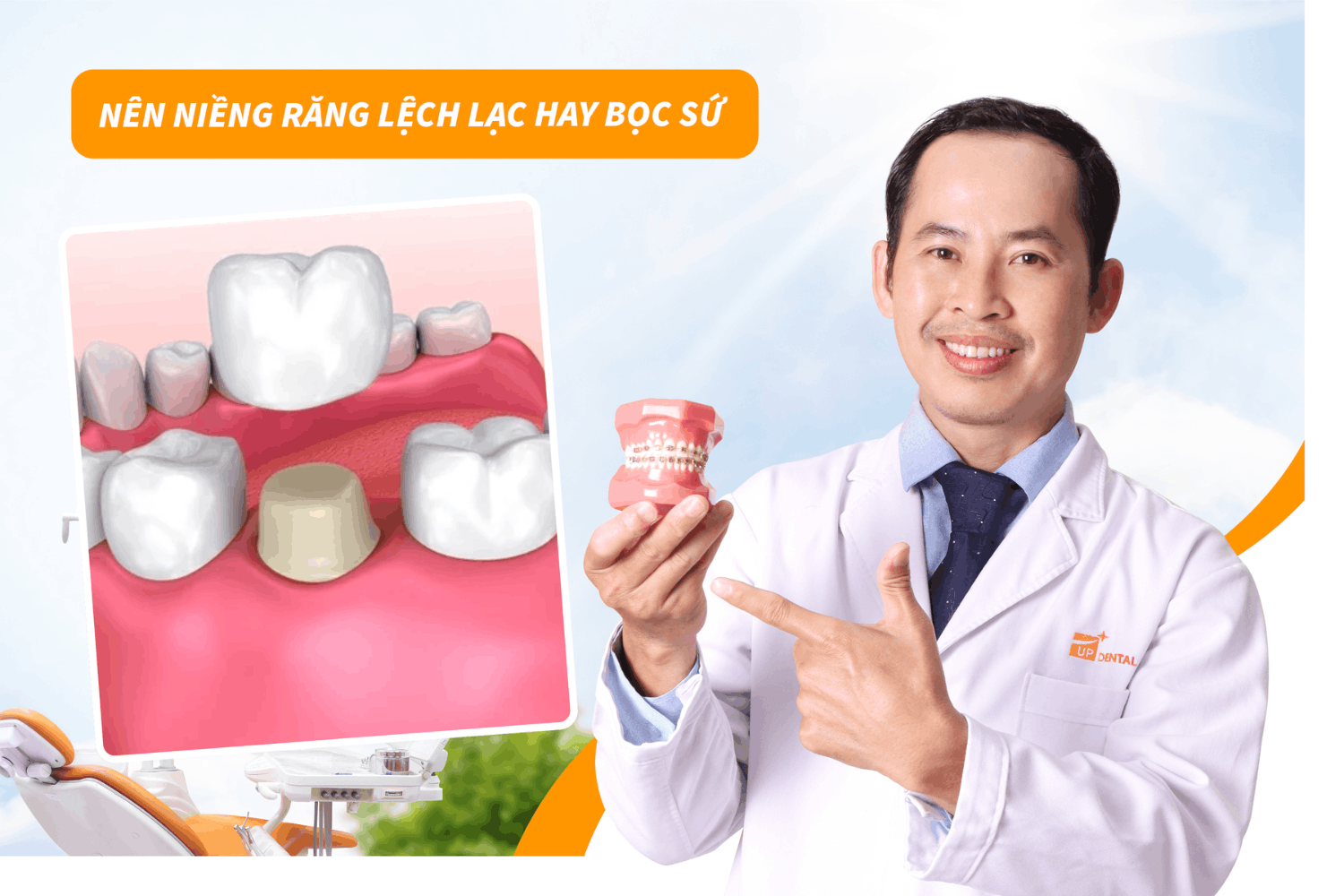 Nên niềng răng lệch lạc hay bọc sứ