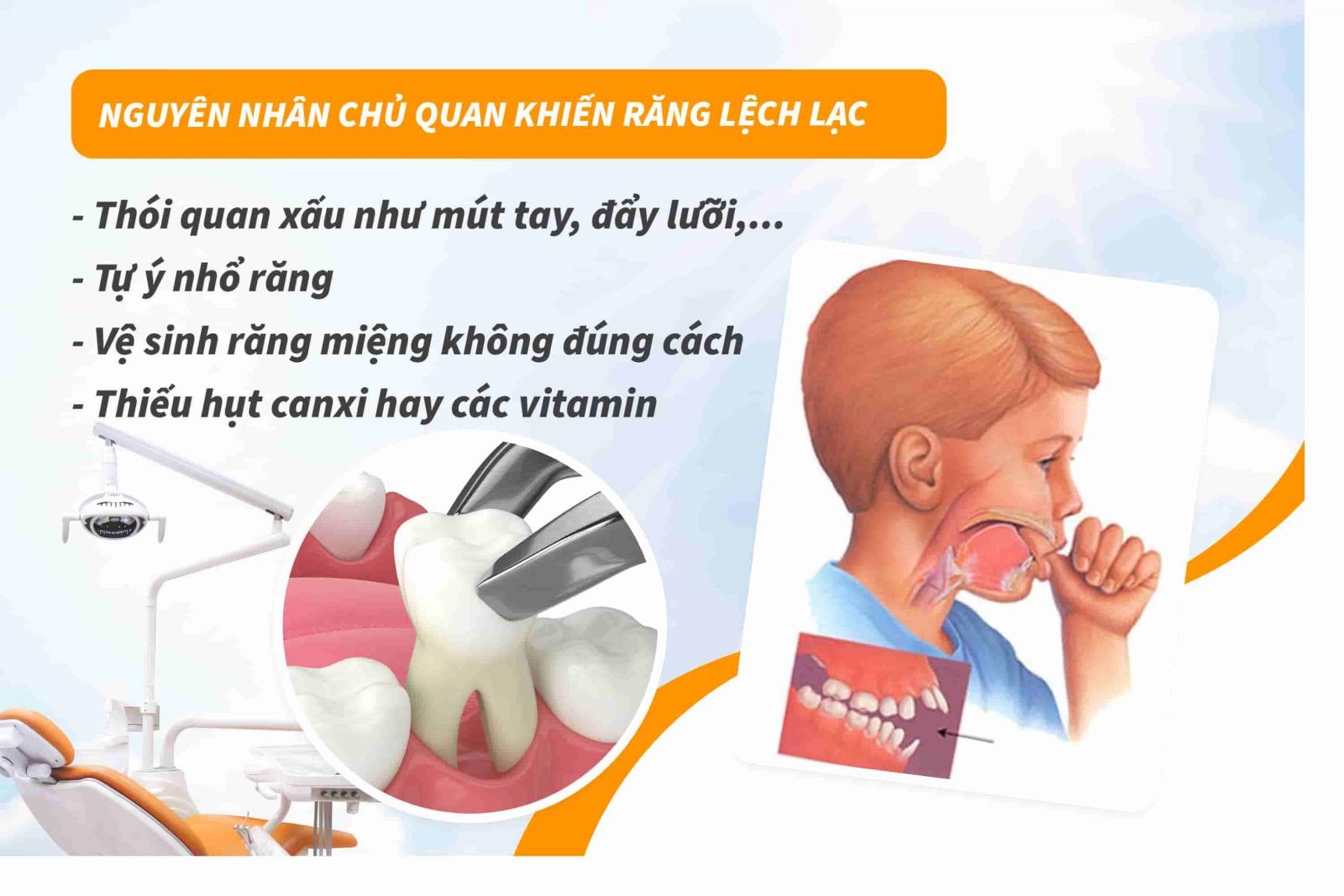 Nguyên nhân chủ quan khiến răng lệch lạc