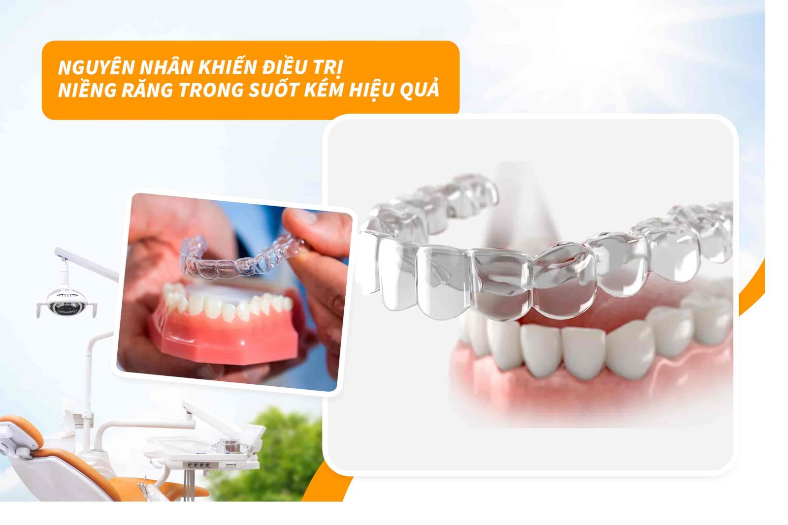 Nguyên nhân khiến điều trị niềng răng trong suốt kém hiệu quả
