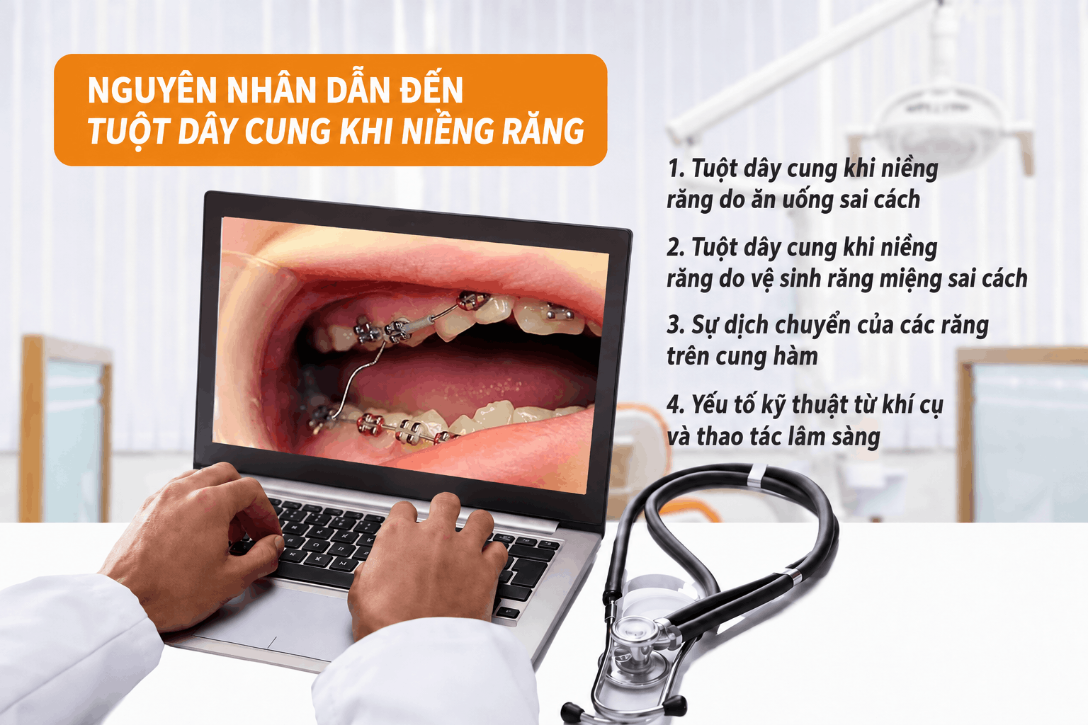 Nguyên nhân dẫn đến tuột dây cung khi niềng răng