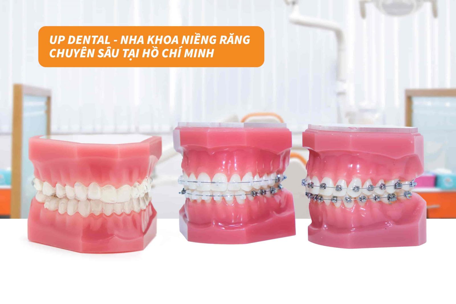 Up Dental - Nha khoa niềng răng chuyên sâu tại Hồ Chí Minh