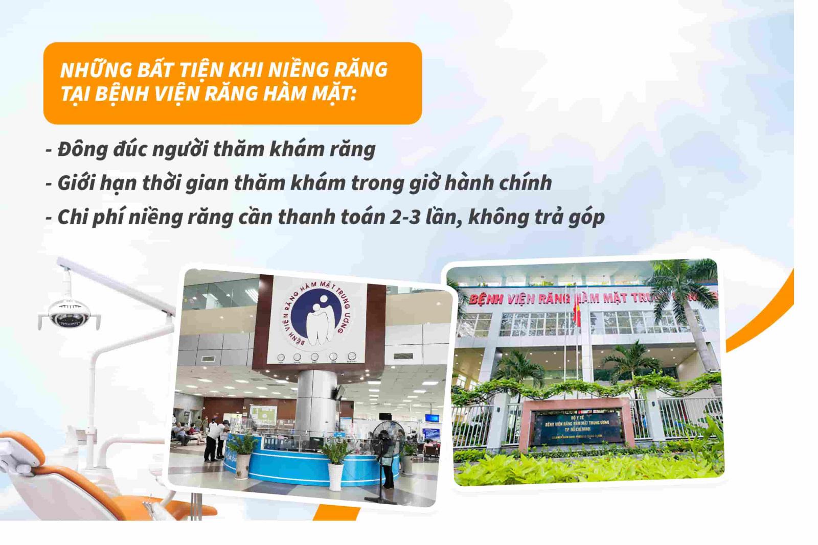 Những bất tiện khi niềng răng tại bệnh viện răng hàm mặt