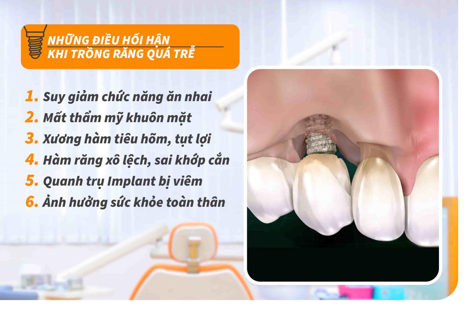 Những điều hối hận khi trồng răng Implant quá trễ
