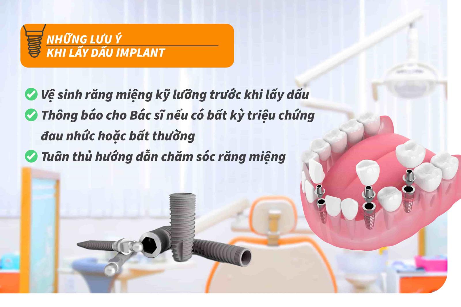 Những lưu ý khi lấy dấu Implant