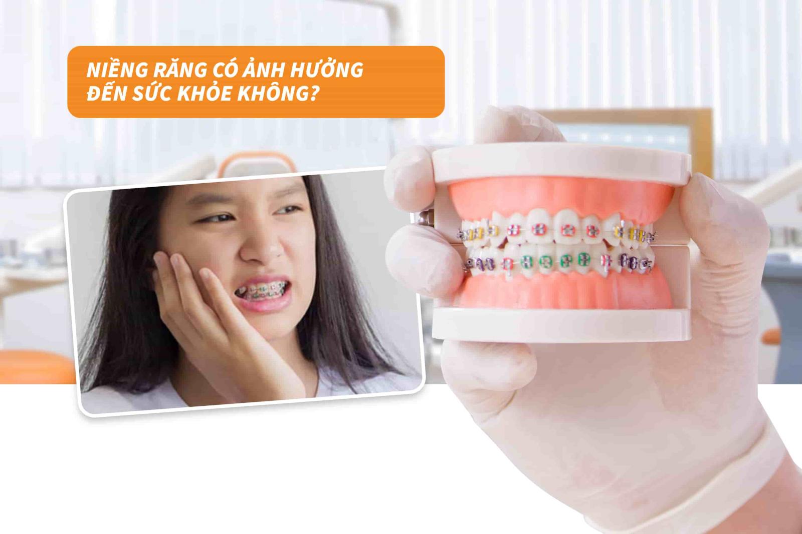 Niềng răng có ảnh hưởng đến sức khỏe không?