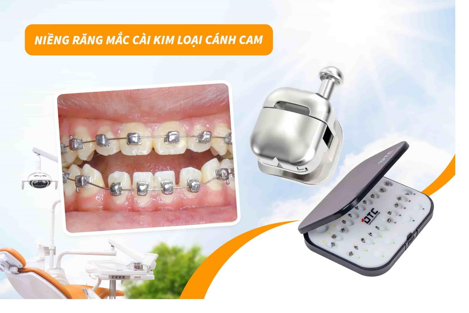 Niềng răng mắc cài kim loại cánh cam