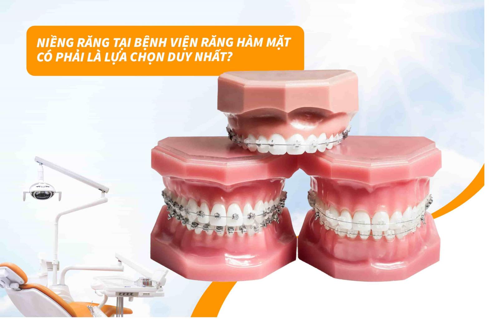 Niềng răng tại bệnh viện răng hàm mặt có phải là lựa chọn duy nhất?