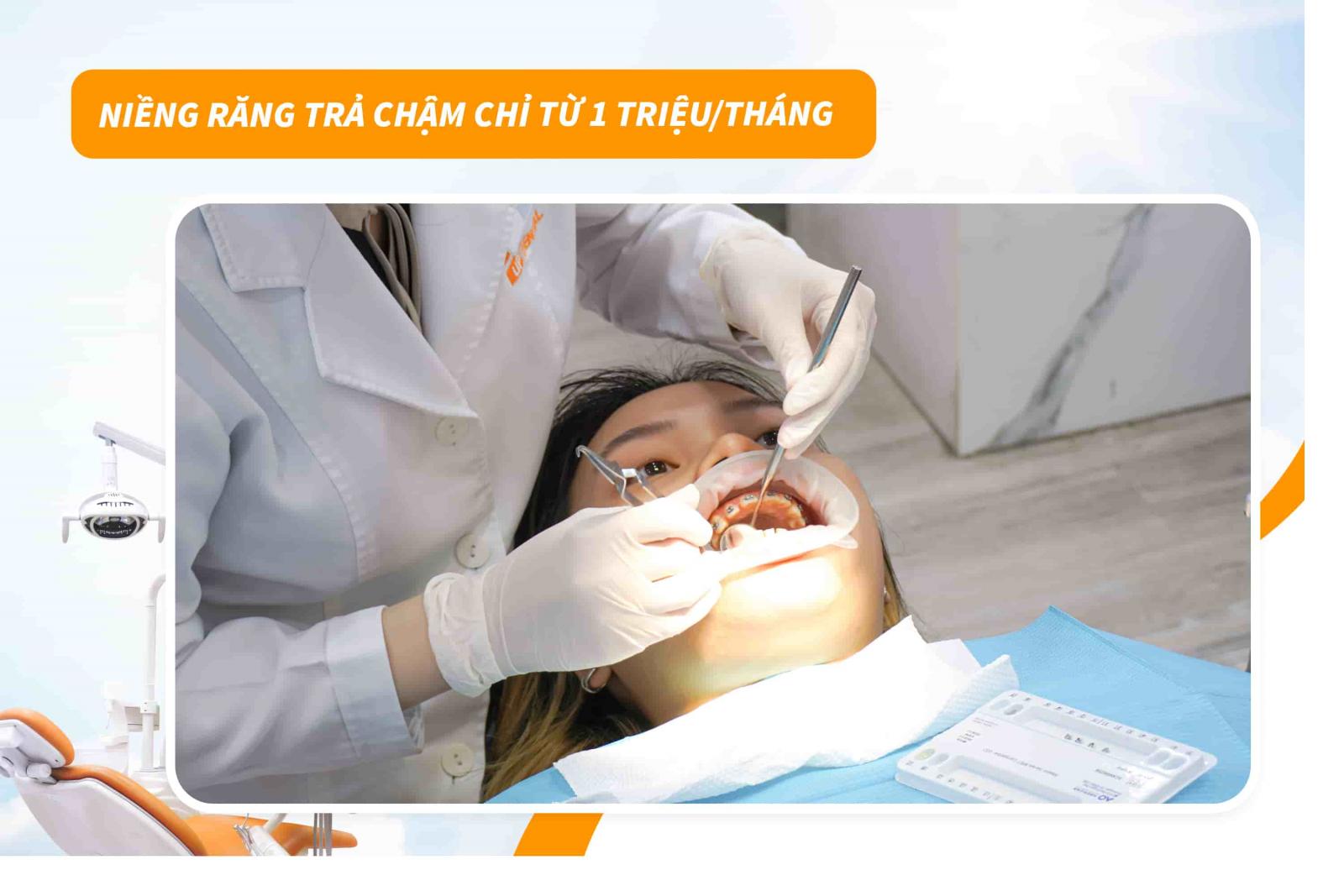 Niềng răng trả chậm chỉ từ 1 triệu/tháng