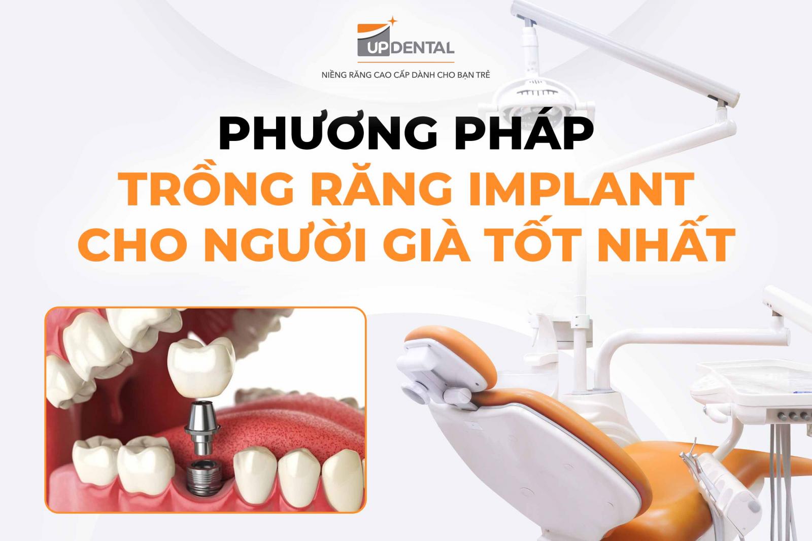 Phương pháp trồng răng Implant cho người già tốt nhất