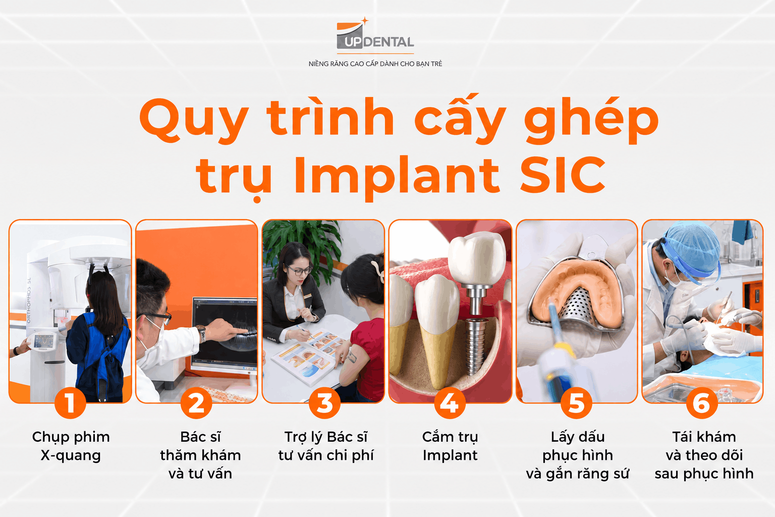 Quy trình cấy ghép trụ Implant SIC