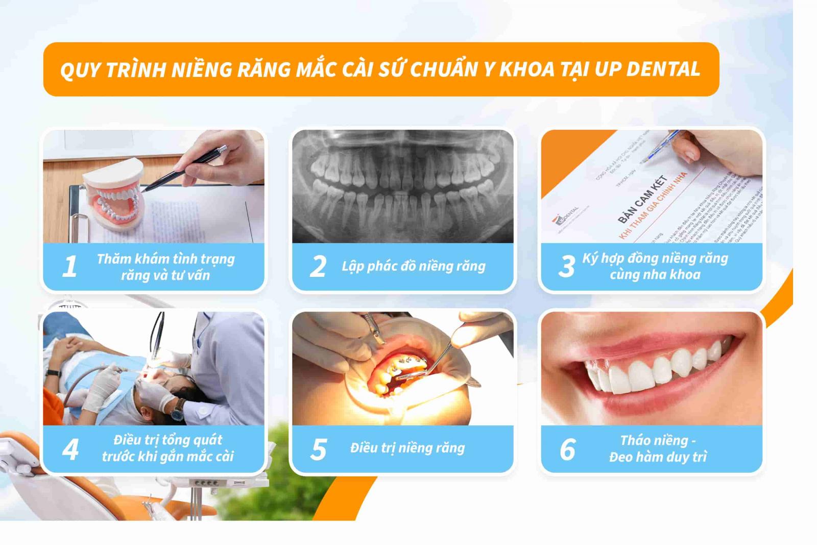 Quy trình niềng răng mắc cài sứ chuẩn Y khoa