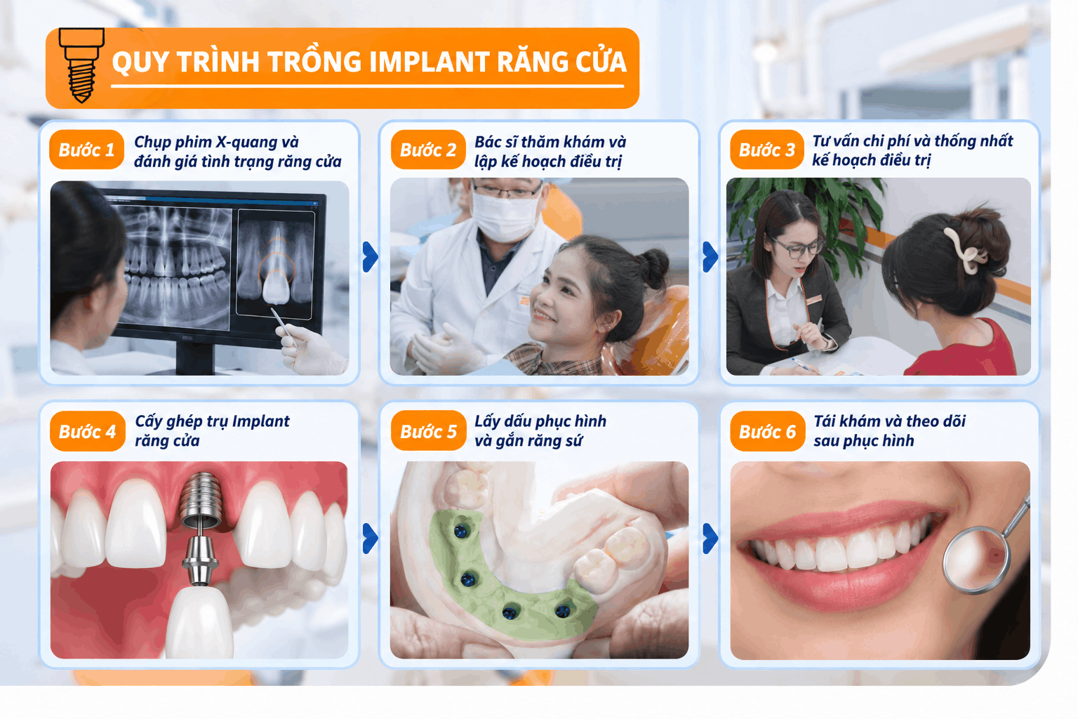 Quy trình trồng Implant răng cửa