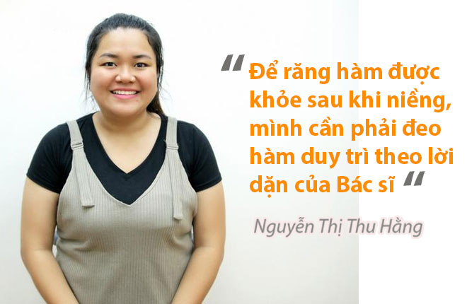Review niềng răng Thu Hằng