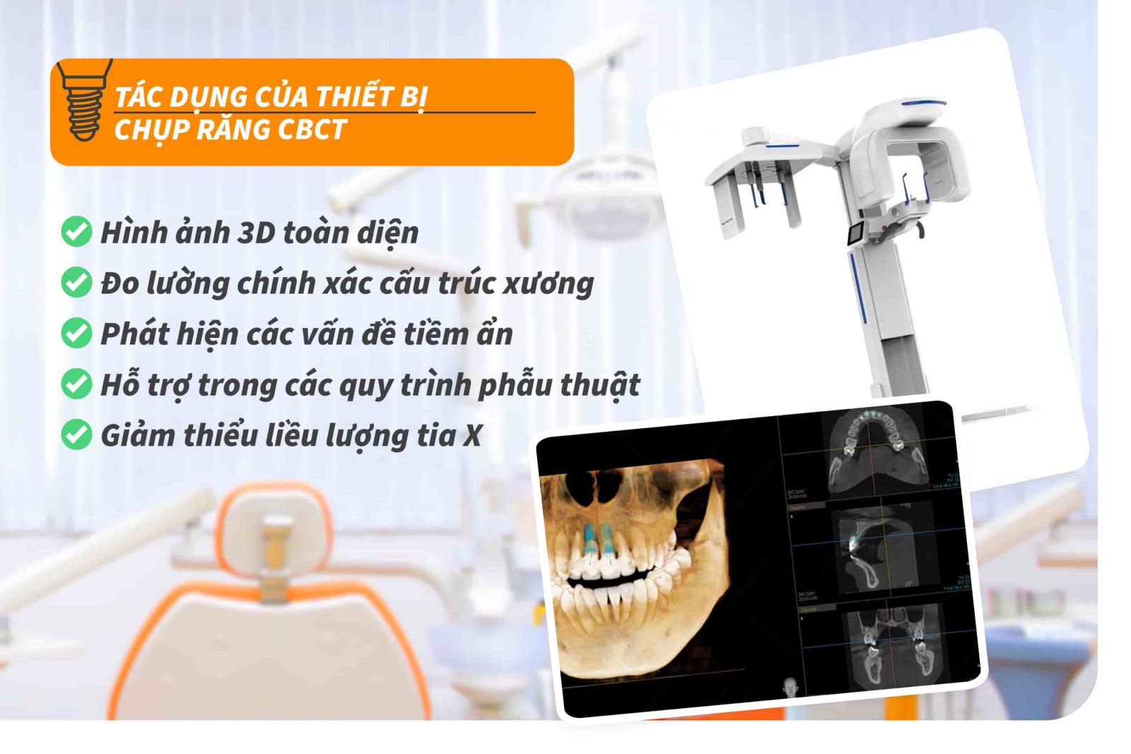 Tác dụng của thiết bị chụp răng CBCT