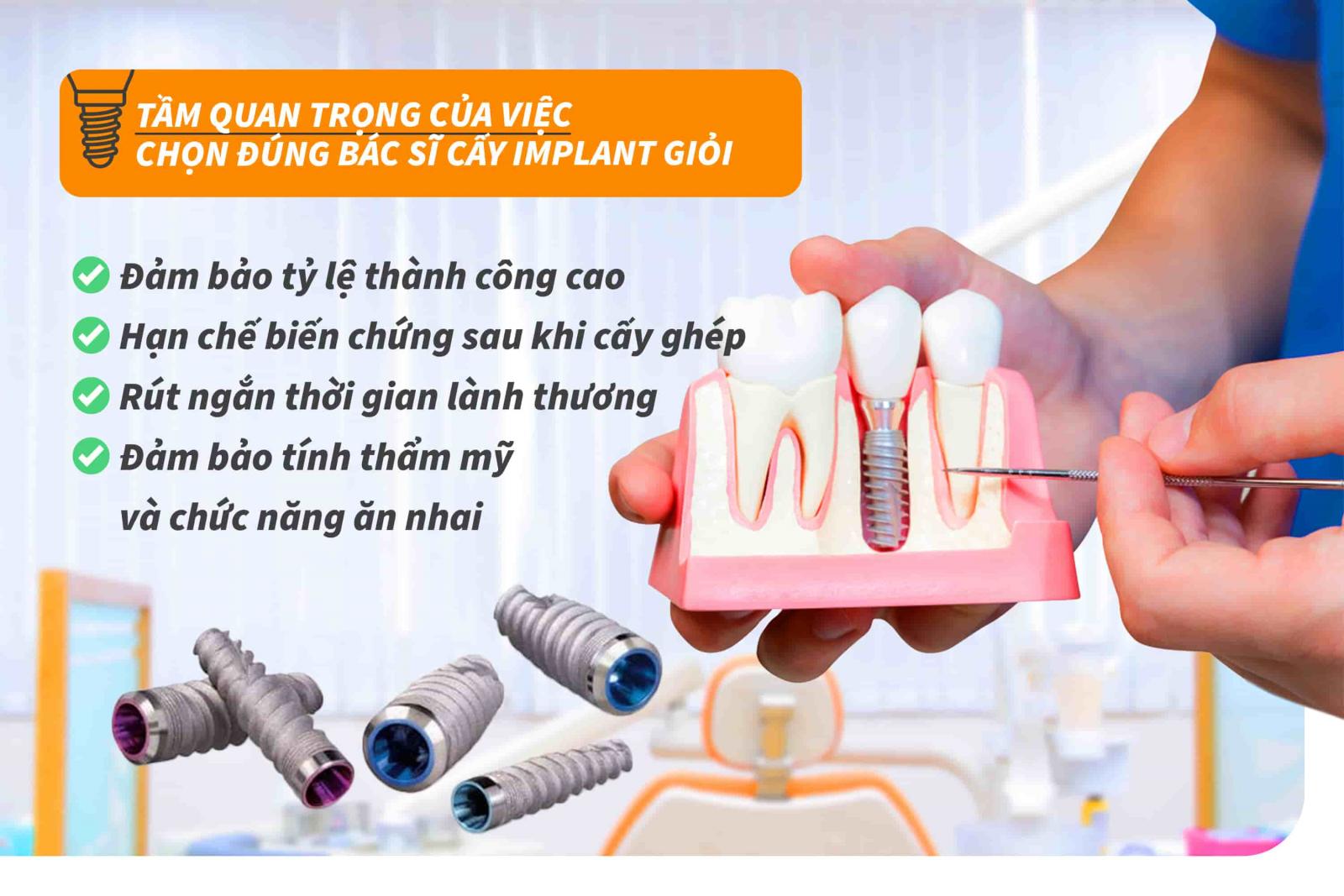Tầm quan trọng của việc chọn đúng Bác sĩ cấy Implant giỏi