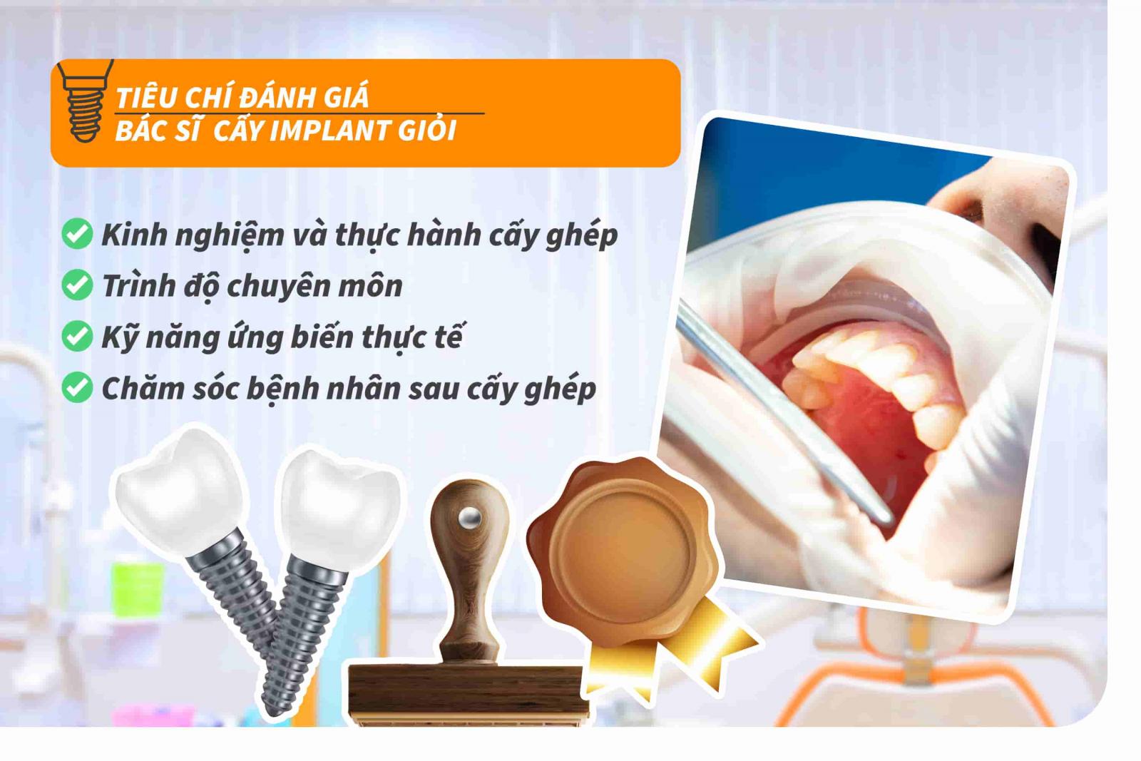 Tiêu chí đánh giá Bác sĩ cấy Implant giỏi