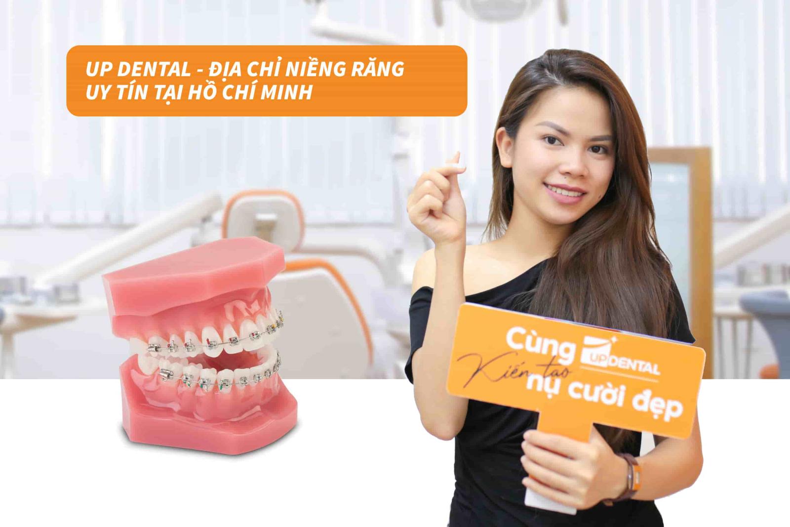 Up Dental - Địa chỉ niềng răng uy tín tại Hồ Chí Minh