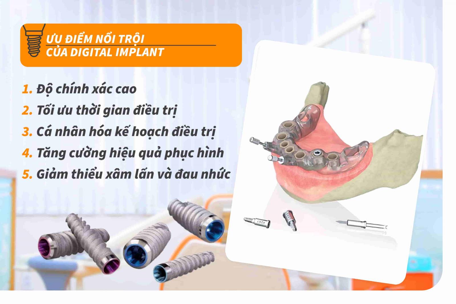 Ưu điểm nổi trội của Digital Implant