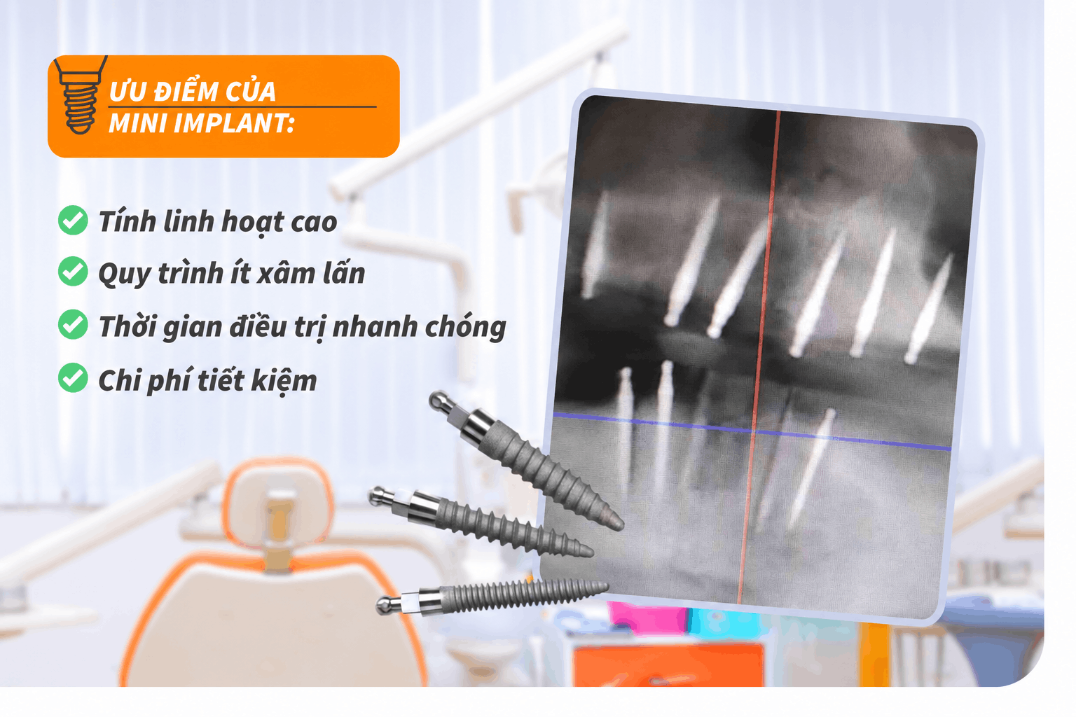 Ưu điểm của cấy ghép mini Implant