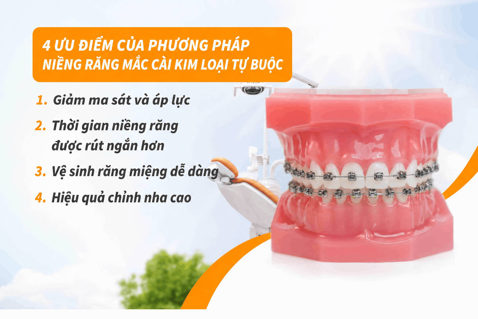 Ưu điểm của phương pháp niềng răng mắc cài kim loại tự buộc