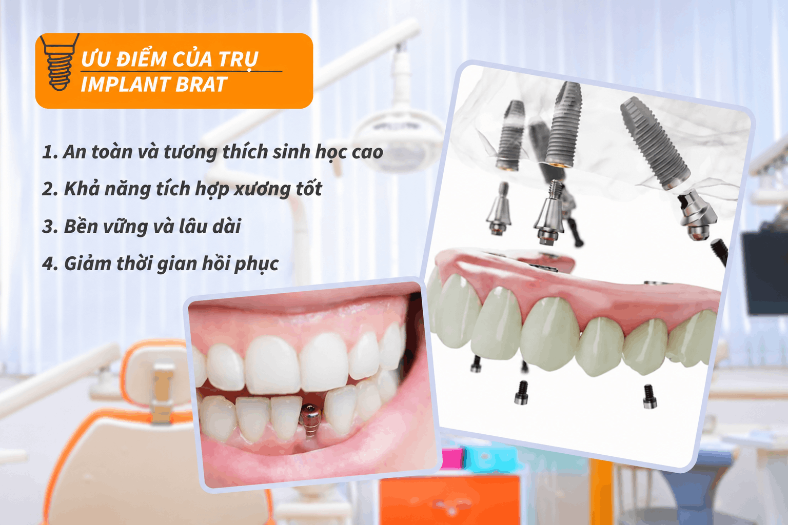 Ưu điểm của trụ Implant Brat