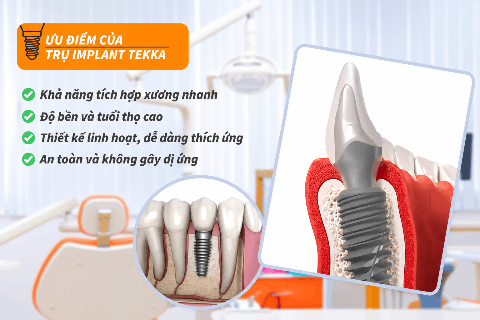 Ưu điểm của trụ Implant Tekka