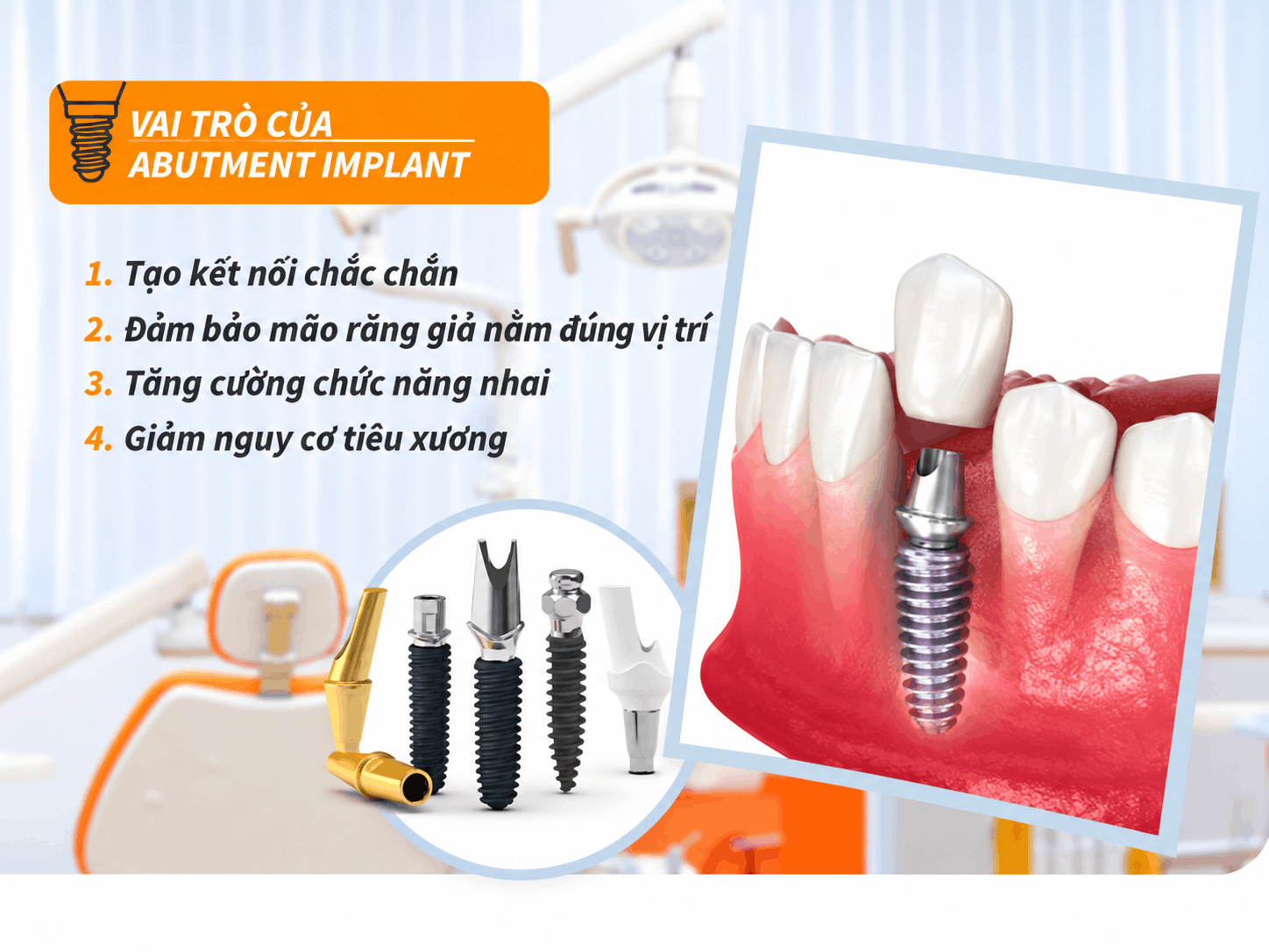 Vai trò của Abutment Implant