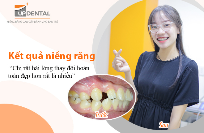 ket-qua-nieng-rang