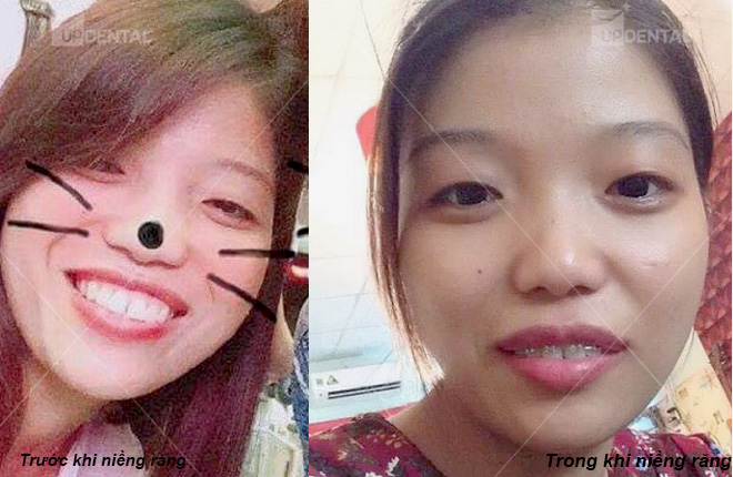 anh rang nieng