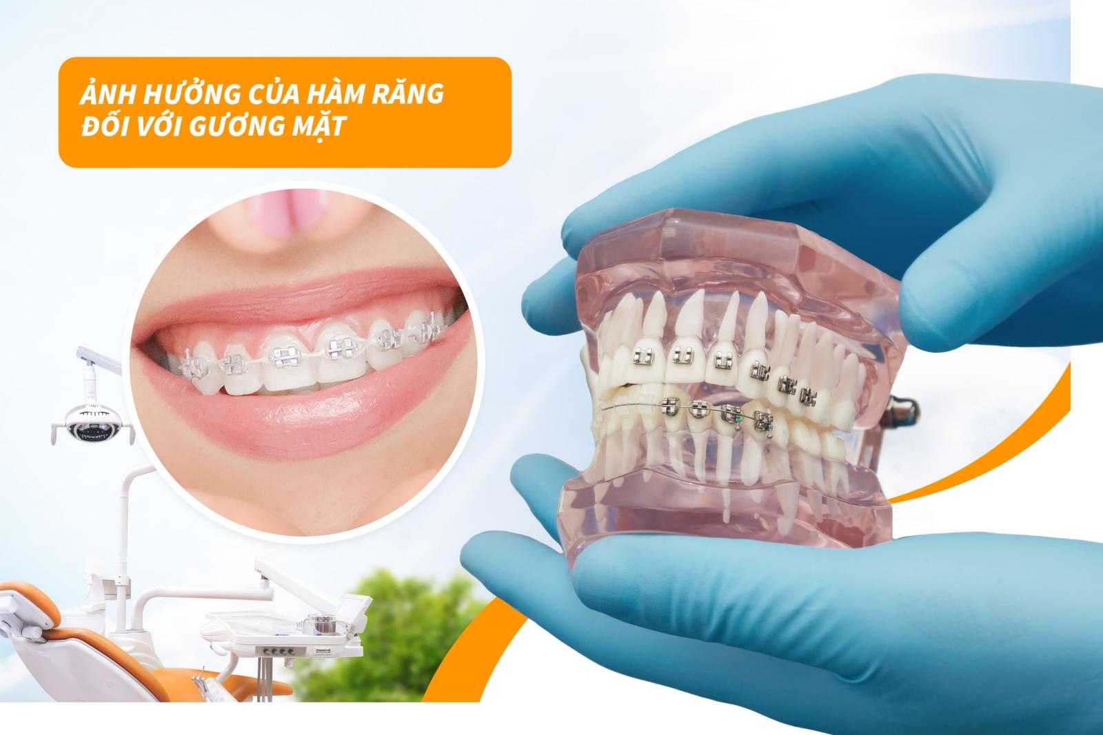 Ảnh hưởng của hàm răng đối với gương mặt