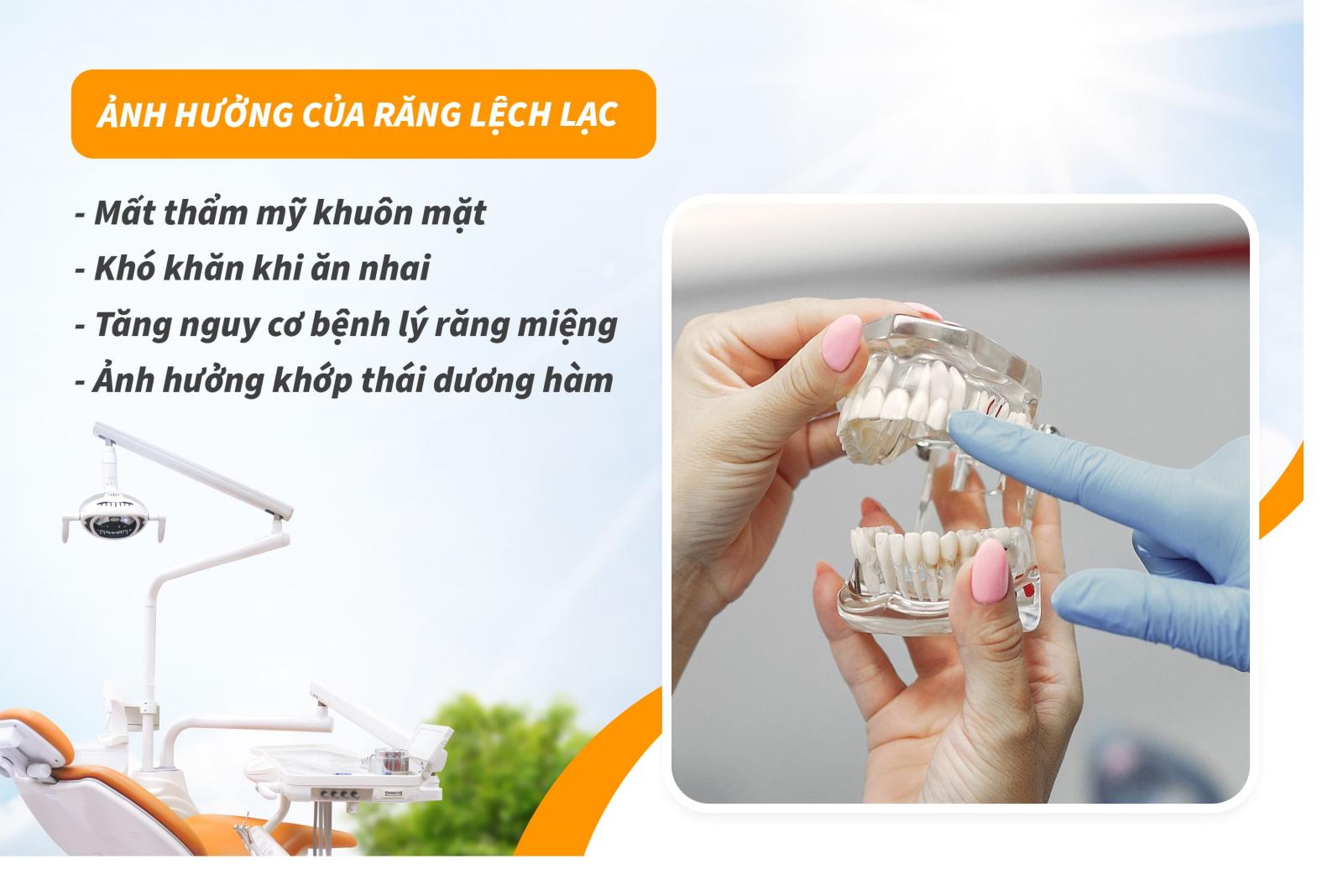 Ảnh hưởng của răng lệch lạc