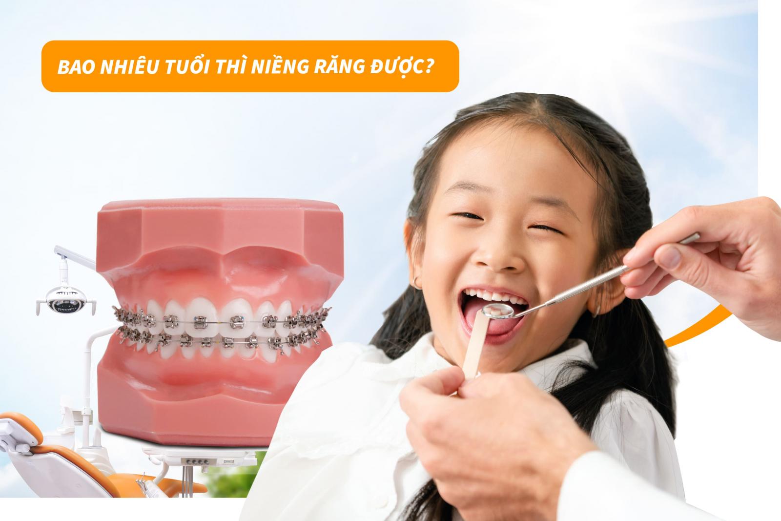 Bao nhiêu tuổi thì niềng răng được?