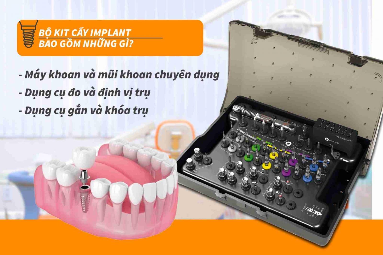 Bộ kit cấy Implant bao gồm những gì?
