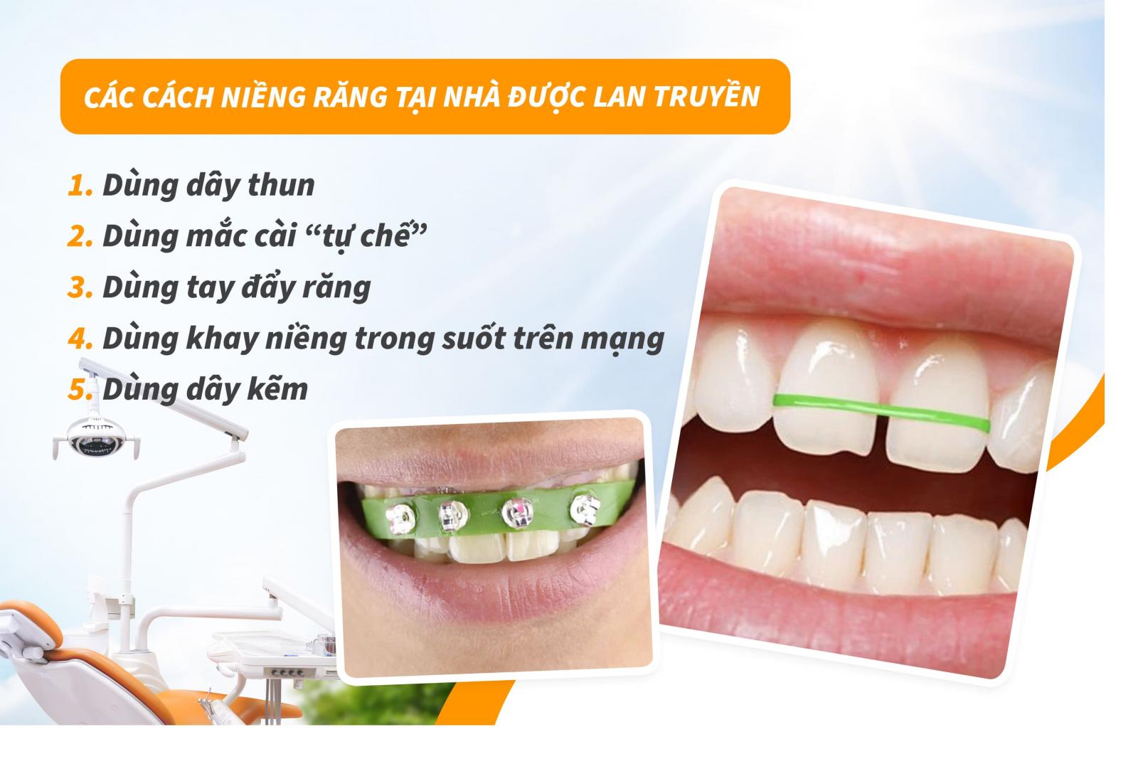 Các cách niềng răng tại nhà được lan truyền