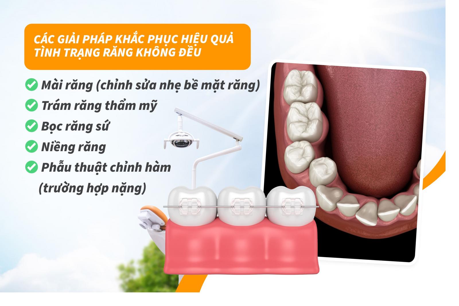 Các giải pháp khắc phục hiệu quả tình trạng răng không đều