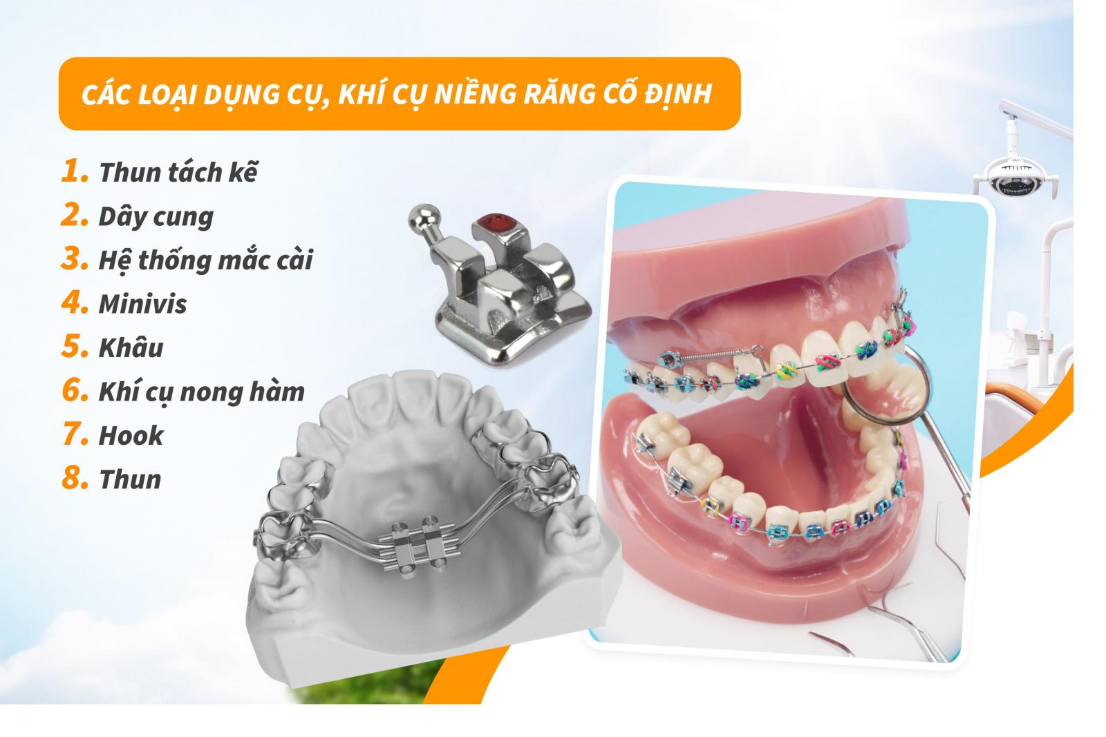 Các loại dụng cụ, khí cụ niềng răng cố định