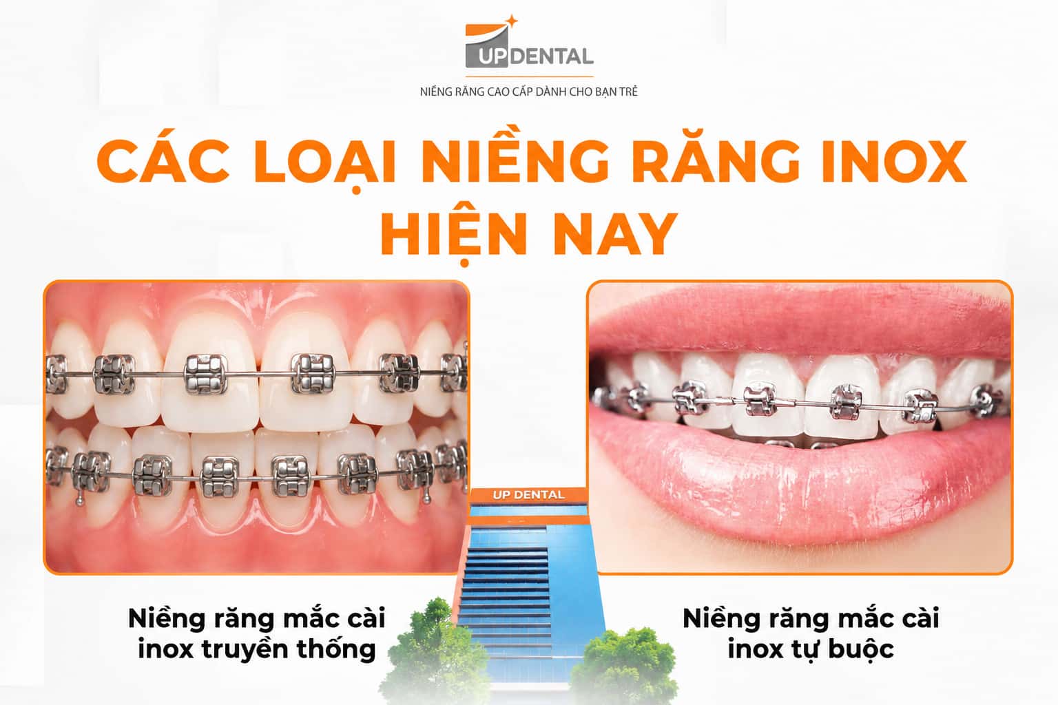 2 loại niềng răng mắc cài inox hiện nay