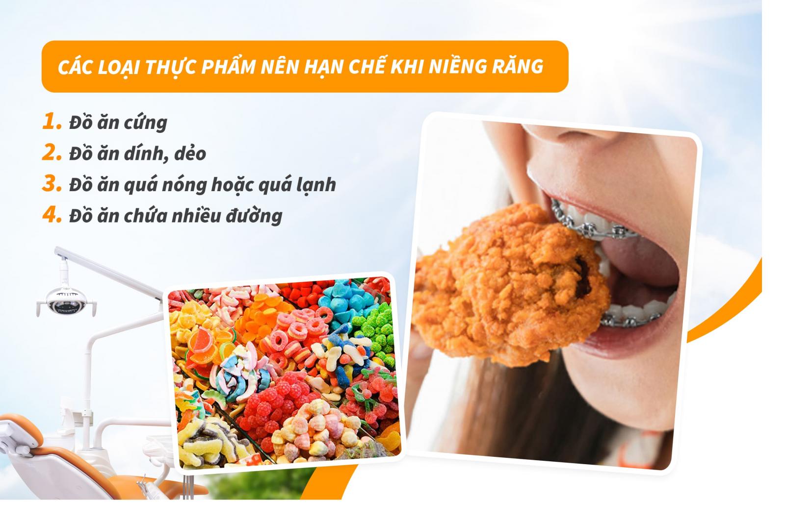 Niềng răng có kiêng gì không?